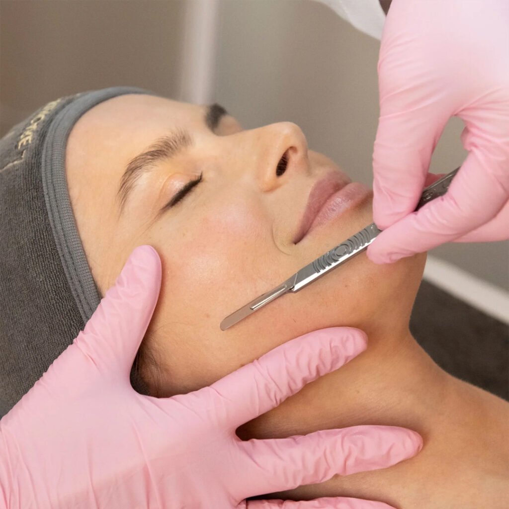 ybeauty spa pembroke pines - Dermaplaning Treatment