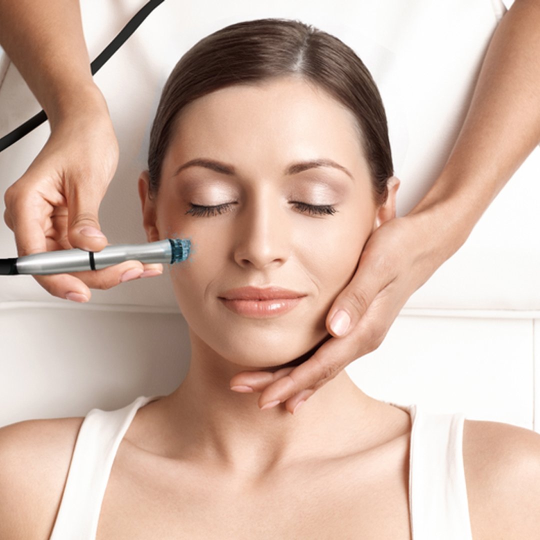 ybeauty spa pembroke pines - Microdermabrasion